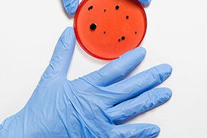 Gloved hand with a petri dish of bacteria