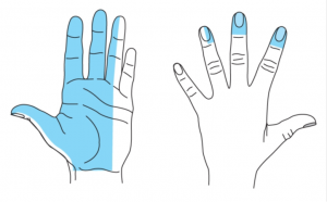 Median nerve block local anaesthetic areas